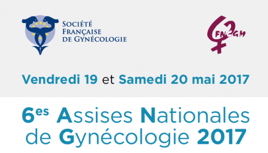 assises